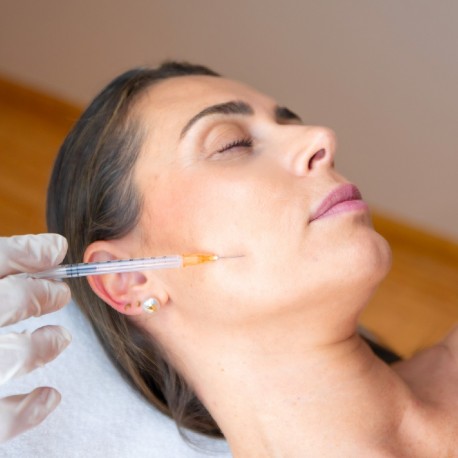 Inductores de Colágeno Radiesse